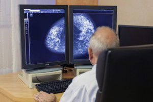 digitale-mammografie-fenzl